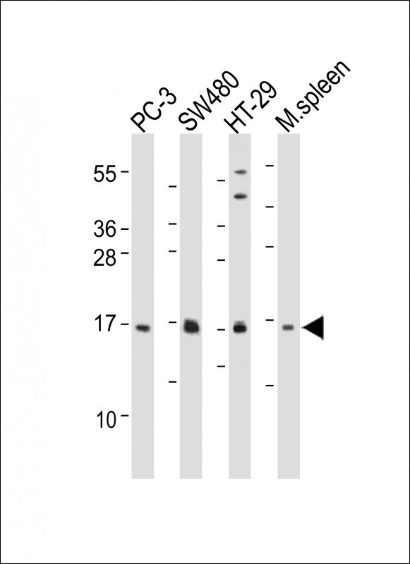 WB - IFITM5 Antibody (Center) AP11058c
