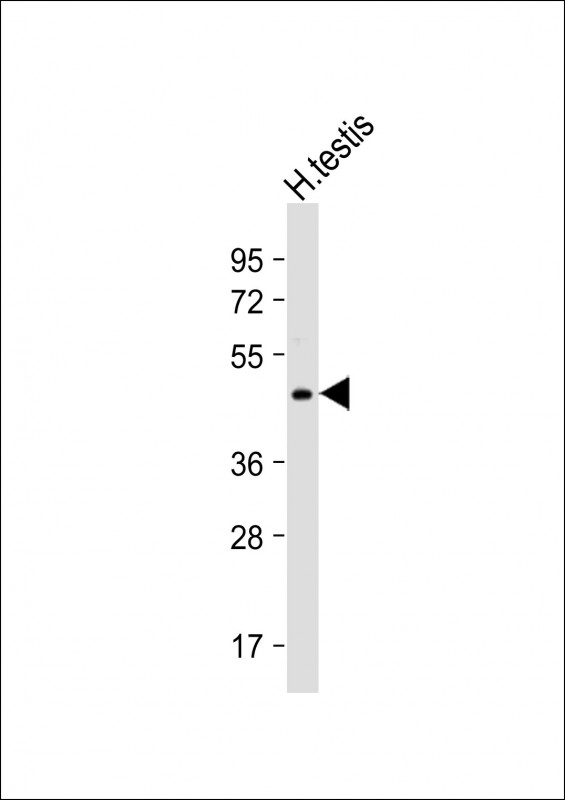 WB - UBXN6 Antibody (C-term) AP5085b