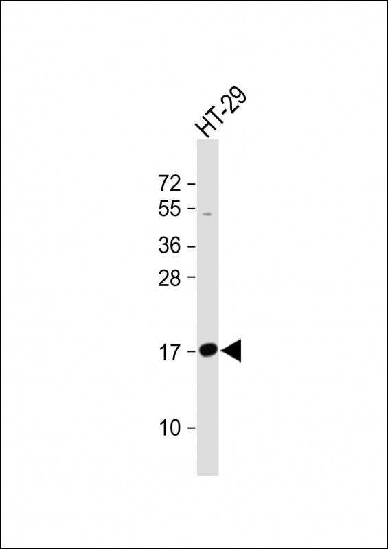WB - IFITM5 Antibody (Center) AP11058c