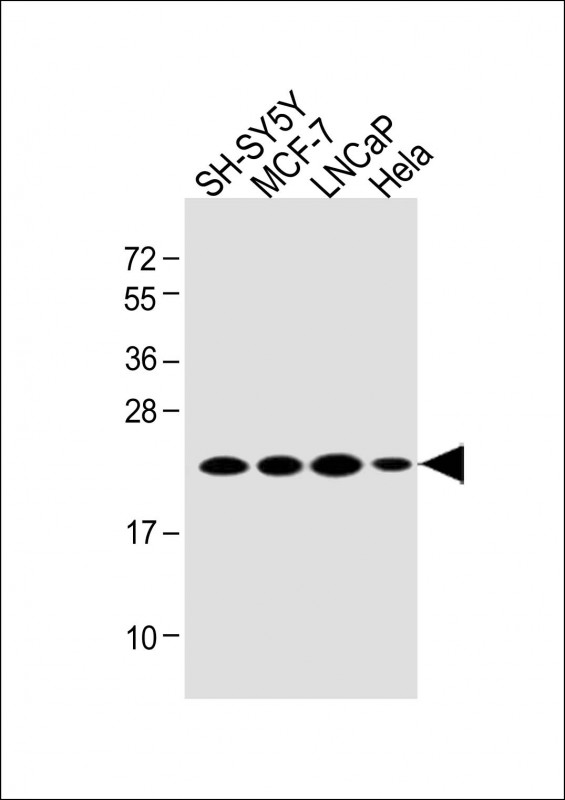 All lanes : Anti-PARK7 Antibody (C-term) at 1:2000 dilutionLane 1: SH-SY5Y whole cell lysateLane 2: MCF-7 whole cell lysateLane 3: LNCaP whole cell lysateLane 4: Hela whole cell lysateLysates/proteins at 20 �g per lane. SecondaryGoat Anti-Rabbit IgG,  (H+L), Peroxidase conjugated at 1/10000 dilution. Predicted band size : 20 kDaBlocking/Dilution buffer: 5% NFDM/TBST.