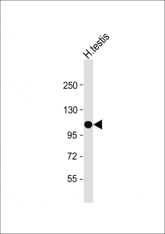 WB - SLC14A2 Antibody (N-Term) AP22353a