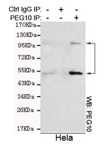 IP - Anti-PEG10 Antibody (1E2-F12-C12) ABV12052-100