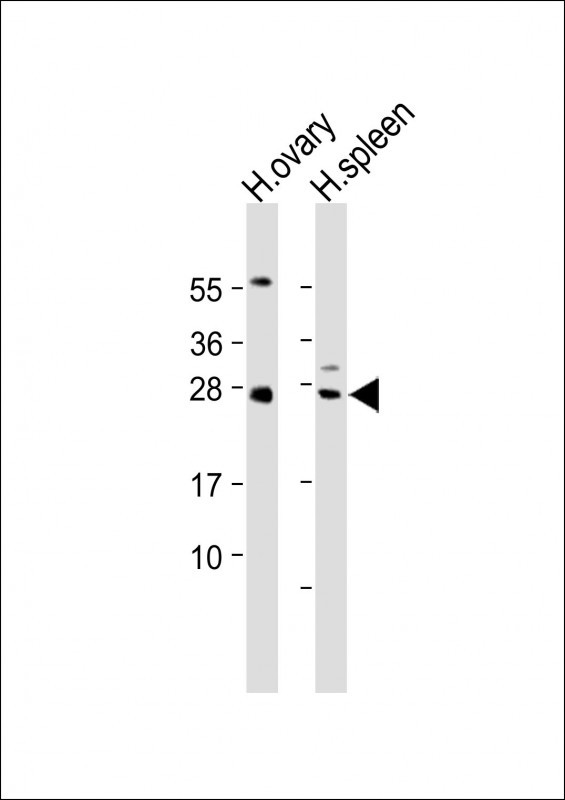 All lanes : Anti-NTF3 Antibody (C-term) at 1:2000 dilutionLane 1: Human ovary lysateLane 2: Human spleen lysateLysates/proteins at 20 �g per lane. SecondaryGoat Anti-Rabbit IgG,  (H+L), Peroxidase conjugated at 1/10000 dilution. Predicted band size : 29 kDaBlocking/Dilution buffer: 5% NFDM/TBST.