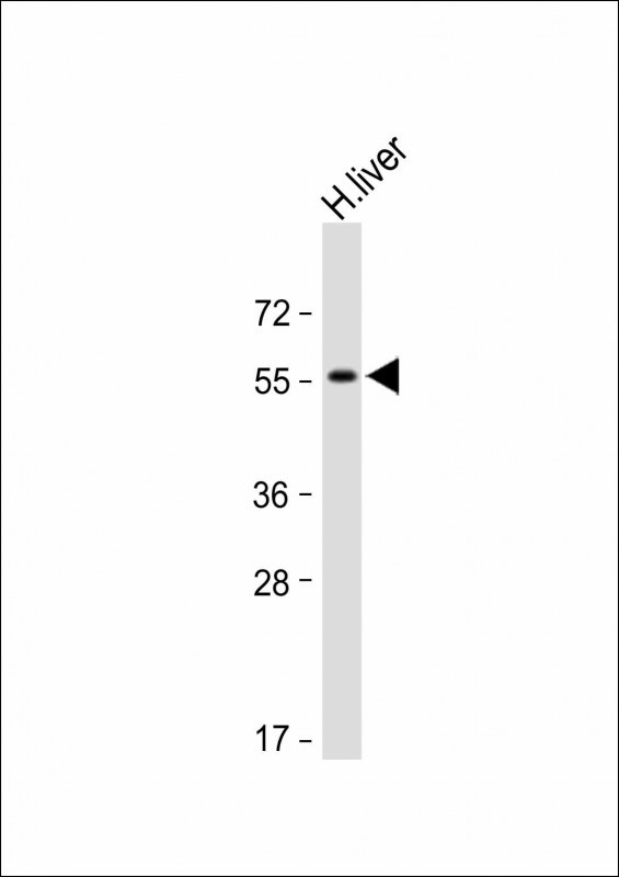 Anti-Activin A Receptor Type IB (ACVR1B) Antibody (N-term) at 1:1000 dilution + Human liver lysate Lysates/proteins at 20 �g per lane. SecondaryGoat Anti-Rabbit IgG,  (H+L), Peroxidase conjugated at 1/10000 dilution. Predicted band size : 55 kDaBlocking/Dilution buffer: 5% NFDM/TBST.