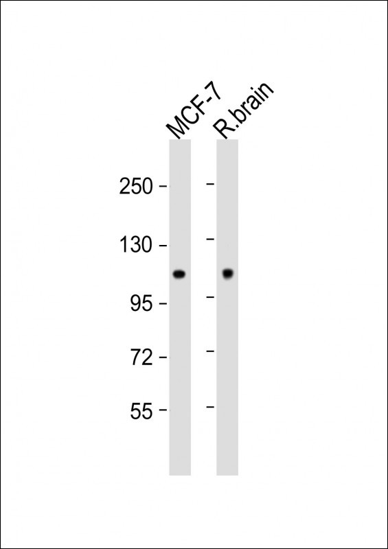 All lanes : Anti-HK1 (Hexokinase) Antibody (N-term) at 1:1000 dilutionLane 1: MCF-7 whole cell lysateLane 2: Rat brain lysateLysates/proteins at 20 �g per lane. SecondaryGoat Anti-Rabbit IgG,  (H+L), Peroxidase conjugated at 1/10000 dilution. Predicted band size : 110 kDaBlocking/Dilution buffer: 5% NFDM/TBST.