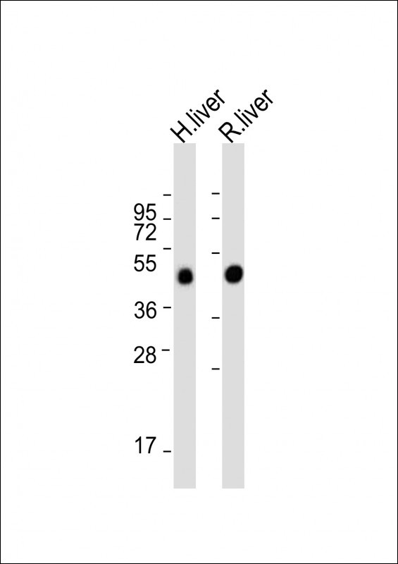 All lanes : Anti-METTL4 Antibody (C-term) at 1:2000 dilutionLane 1: Huamn liver lysateLane 2: Rat liver lysateLysates/proteins at 20 �g per lane. SecondaryGoat Anti-Rabbit IgG,  (H+L), Peroxidase conjugated at 1/10000 dilution. Predicted band size : 54 kDaBlocking/Dilution buffer: 5% NFDM/TBST.