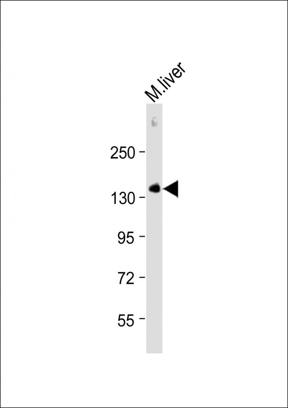 Anti-M CD31 Antibody (C-term) at 1:2000 dilution + Mouse liver lysateLysates/proteins at 20 �g per lane. SecondaryGoat Anti-Rabbit IgG,  (H+L), Peroxidase conjugated at 1/10000 dilution. Predicted band size : 81 kDaBlocking/Dilution buffer: 5% NFDM/TBST.