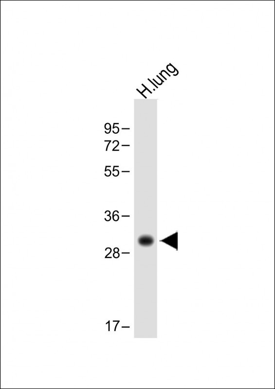 Anti-HLA-DPB1 Antibody (Center) at 1:1000 dilution + Human lung lysateLysates/proteins at 20 �g per lane. SecondaryGoat Anti-Rabbit IgG,  (H+L), Peroxidase conjugated at 1/10000 dilution. Predicted band size : 30 kDaBlocking/Dilution buffer: 5% NFDM/TBST.