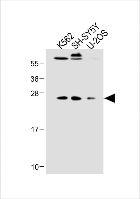 WB - N6AMT1 Antibody (N-term) AP18103a
