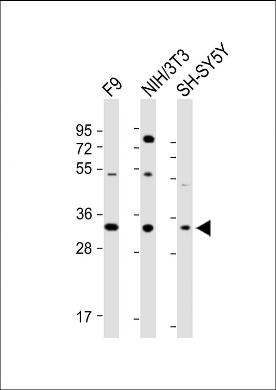 All lanes : Anti-WDR82 Antibody (N-term) at 1:1000 dilutionLane 1: F9 whole cell lysateLane 2:NIH/3T3 whole cell lysateLane 3: SH-SY5Y whole cell lysateLysates/proteins at 20 �g per lane. SecondaryGoat Anti-Rabbit IgG,  (H+L), Peroxidase conjugated at 1/10000 dilution. Predicted band size : 35 kDaBlocking/Dilution buffer: 5% NFDM/TBST.