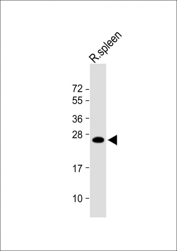 Anti-LIF Antibody (Center) at 1:1000 dilution + Rat spleen lysateLysates/proteins at 20 �g per lane. SecondaryGoat Anti-Rabbit IgG,  (H+L), Peroxidase conjugated at 1/10000 dilution. Predicted band size : 25 kDaBlocking/Dilution buffer: 5% NFDM/TBST.