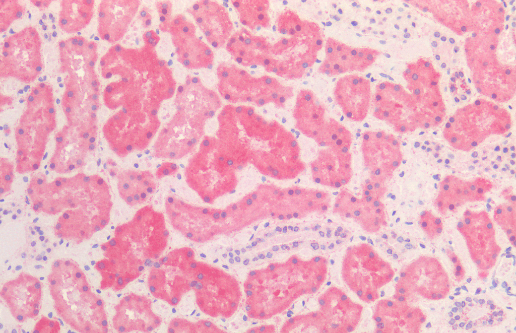 IHC - HSP60 Antibody ASM10018