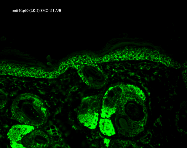 IHC - HSP60 Antibody ASM10018