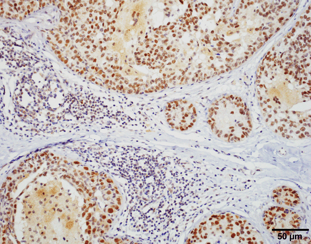 IHC - HSF1 Antibody ASM10028
