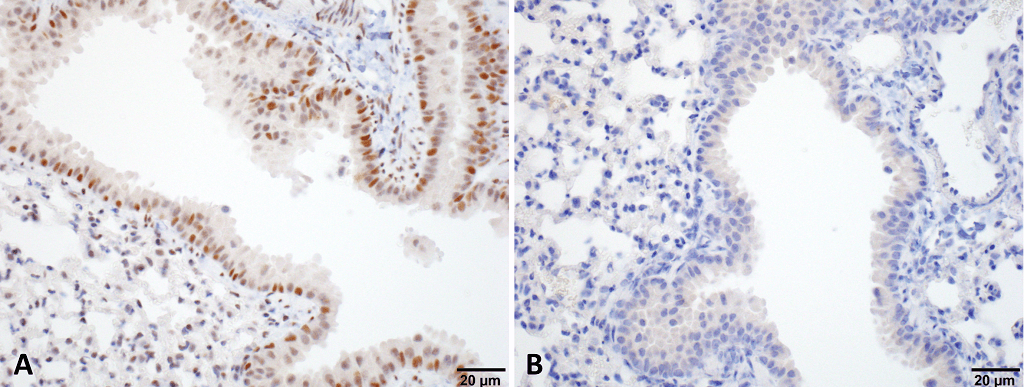 IHC - HSF1 Antibody ASM10028