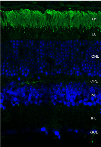 IHC - Rhodopsin Antibody ASM10114