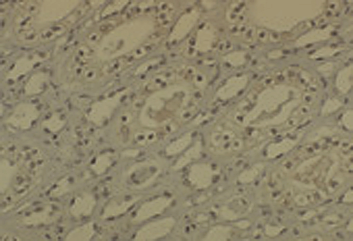 IHC - DNMT1 Antibody ASM10147