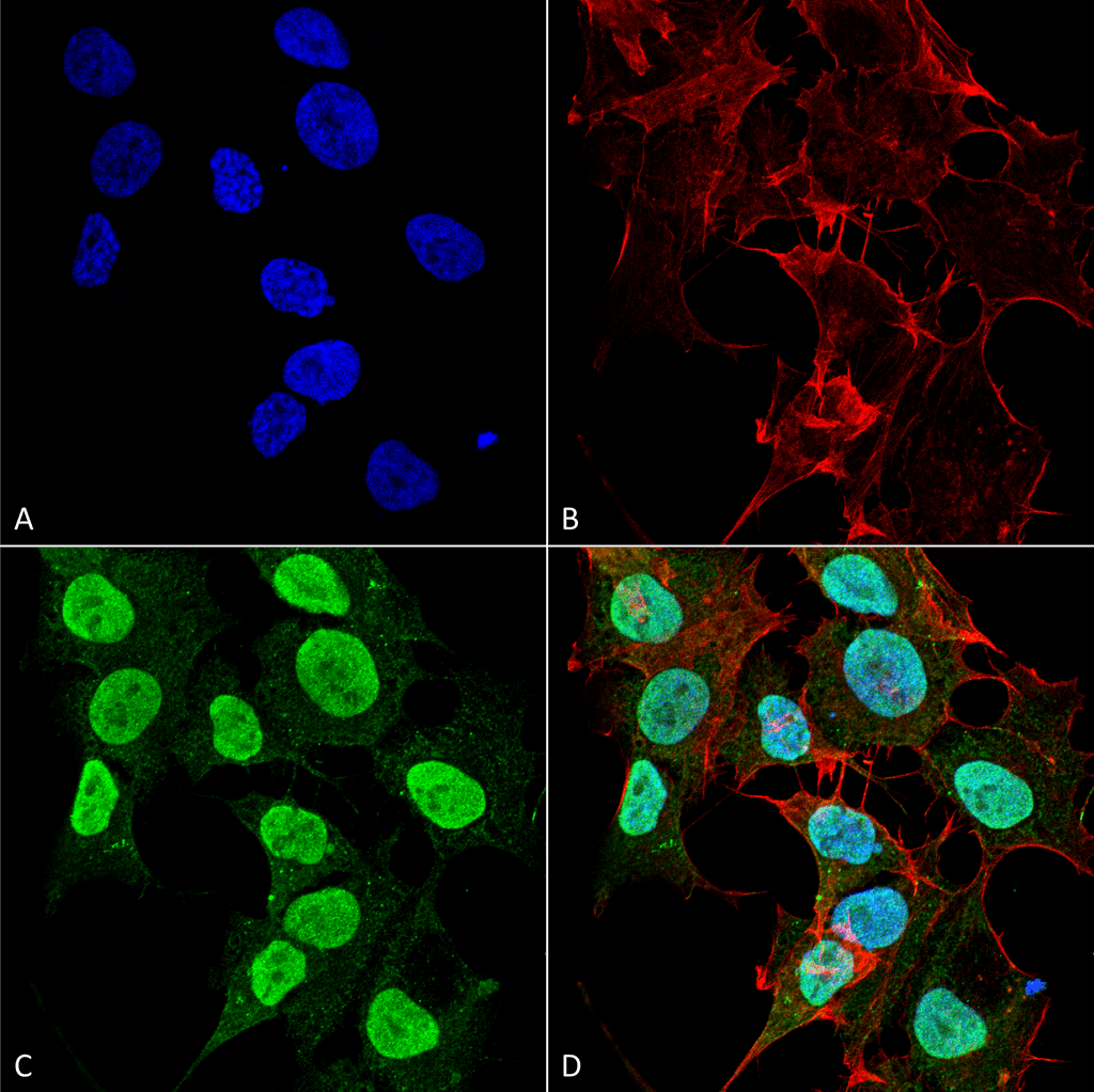  - Cav1.2 Antibody ASM10178