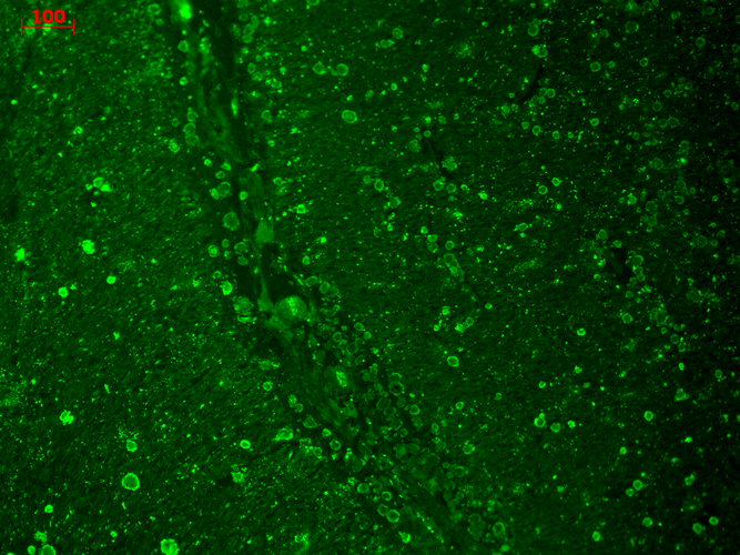 IHC - Cav1.2 Antibody ASM10178