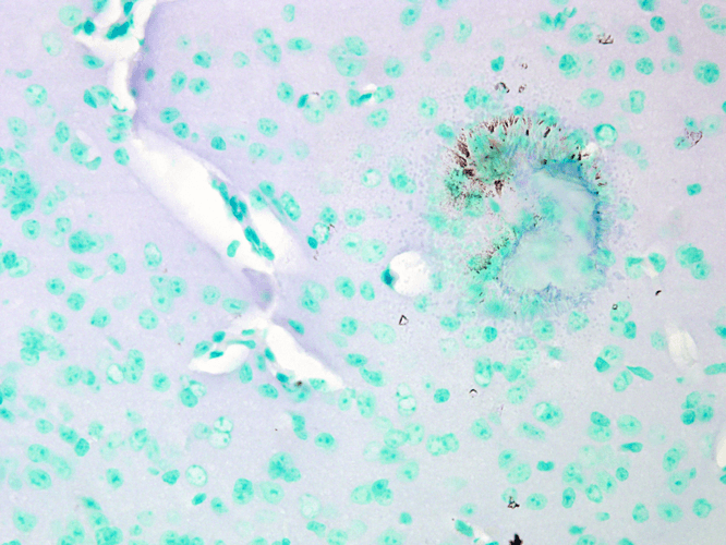 IHC - Cav1.2 Antibody ASM10178