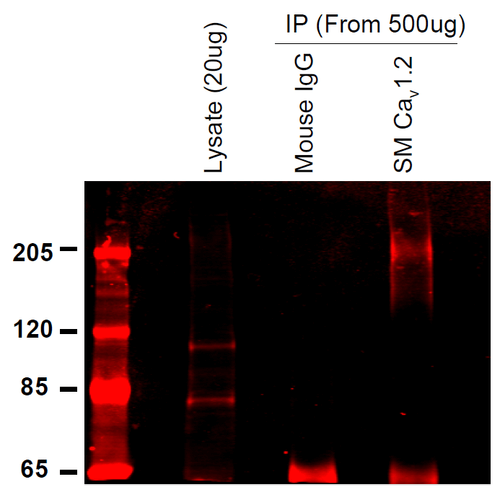 IP - Cav1.2 Antibody ASM10178