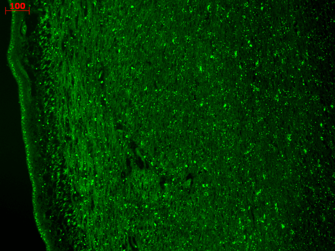 IHC - Cav3.2 Antibody ASM10181