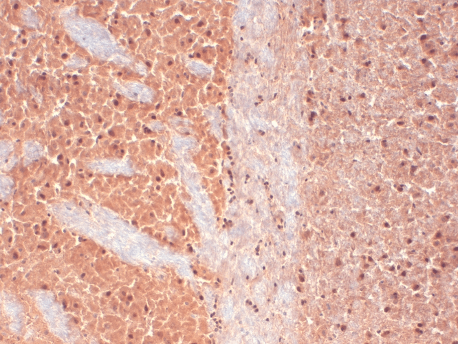 IHC - Cav3.2 Antibody ASM10181