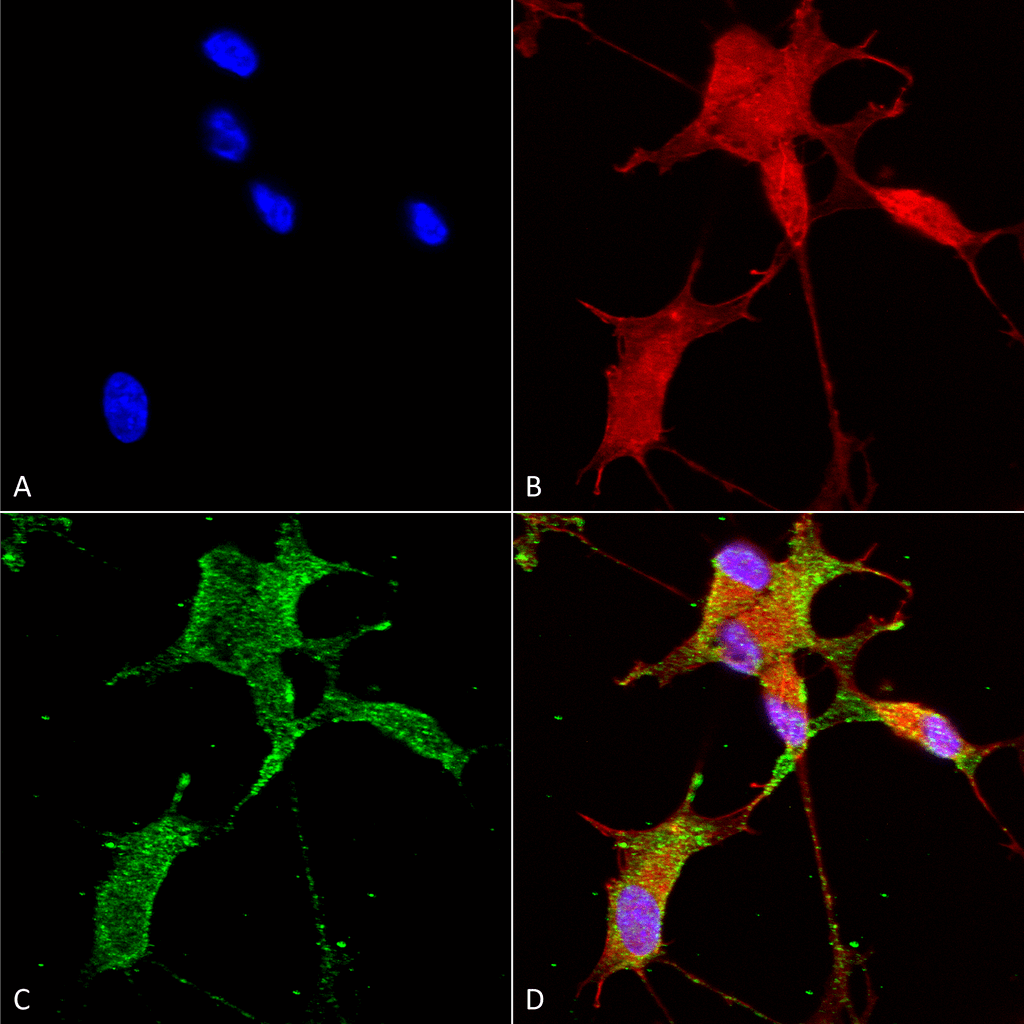 IF - Cav3.2 Antibody ASM10181
