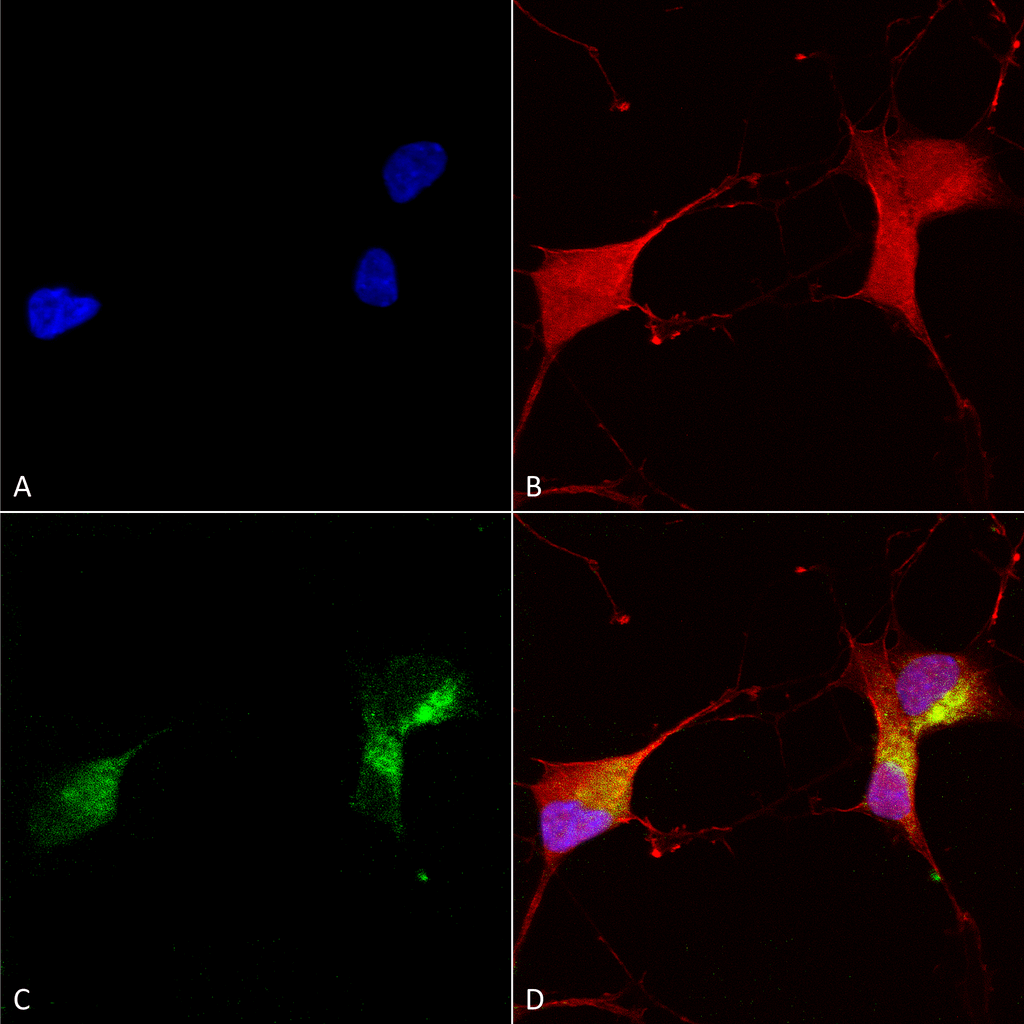  - KCNQ1 Antibody ASM10185