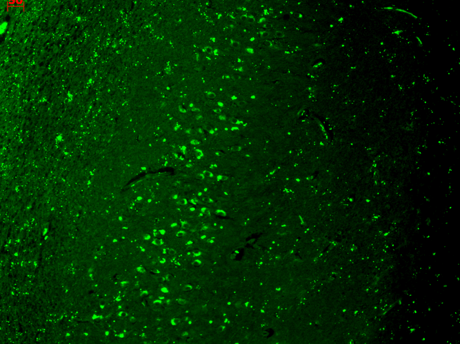 IHC - TrpV3 Antibody ASM10197