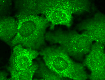  - Cav beta 2 Antibody ASM10208