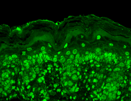 IHC - Cav beta 2 Antibody ASM10208