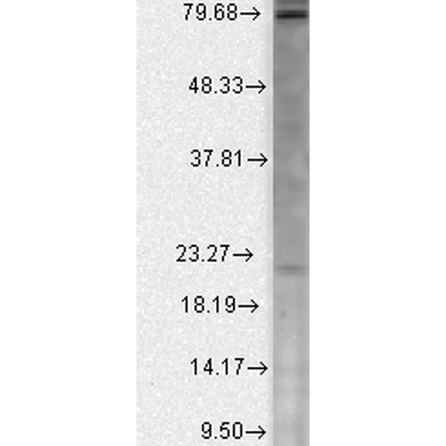 WB - Cav beta 2 Antibody ASM10208