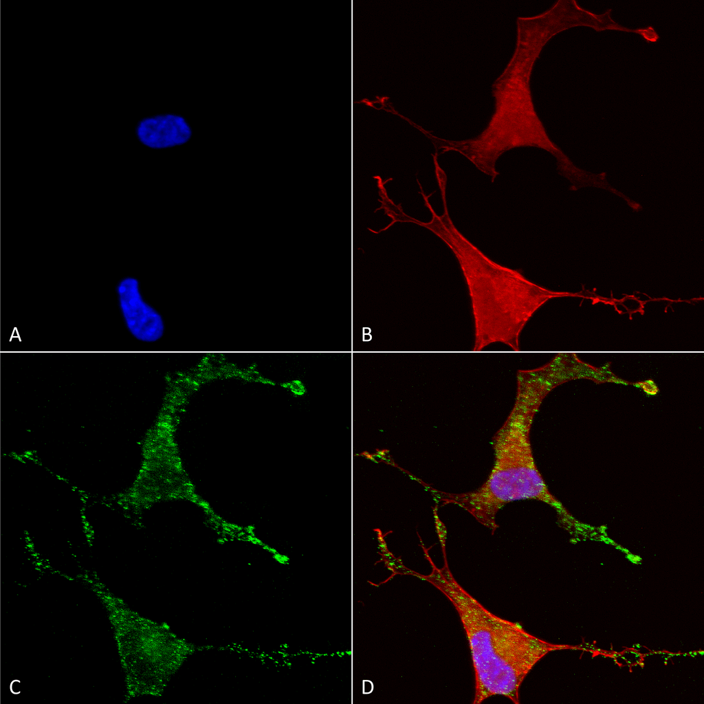  - Cav beta 2 Antibody ASM10208