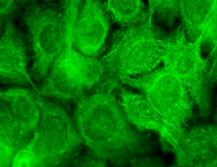  - TrpV3 Antibody ASM10210