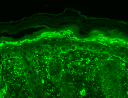 IHC - TrpV3 Antibody ASM10210