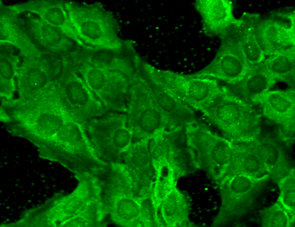  - GluN2B/NR2B Antibody ASM10213