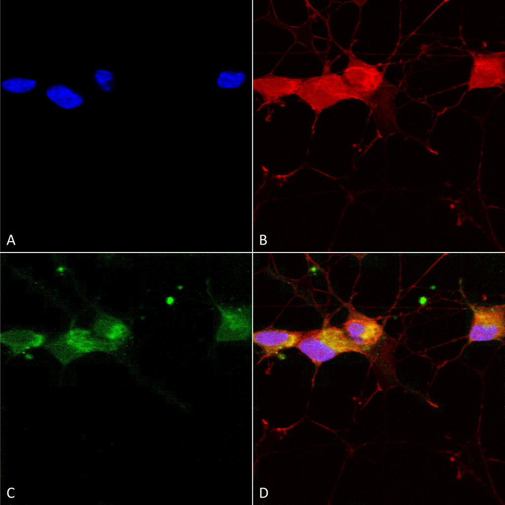  - GluN2B/NR2B Antibody ASM10213