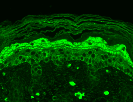 IHC - GluN2B/NR2B Antibody ASM10213