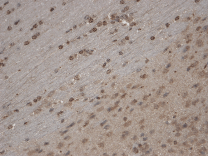 IHC - TrpC5 Antibody ASM10220