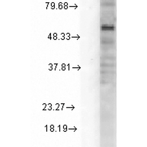 WB - GABA-A Receptor Delta Antibody ASM10221