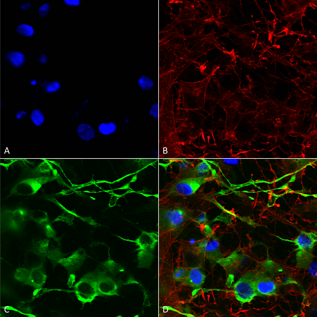  - KCC2 Antibody ASM10226