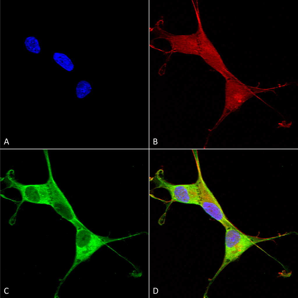  - Copper Transporting ATPase 1 Antibody ASM10232