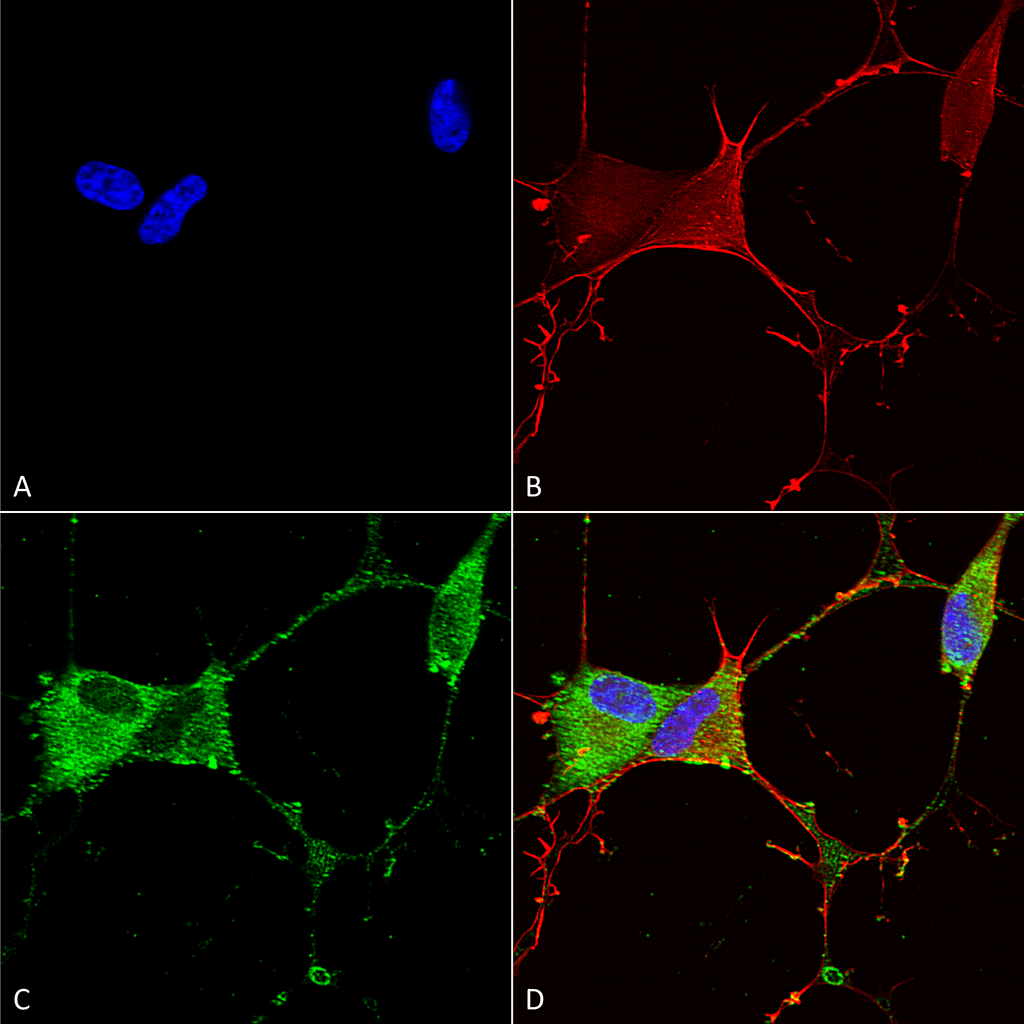 - GABA-B Receptor 2 Antibody ASM10236