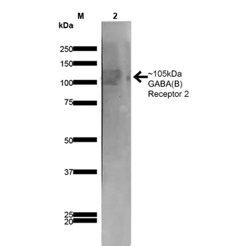 WB - GABA-B Receptor 2 Antibody ASM10236