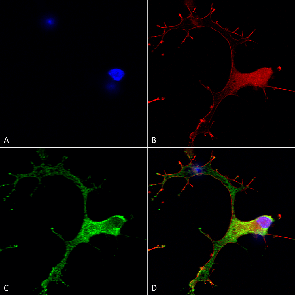  - GABA-B Receptor 1 Antibody ASM10237