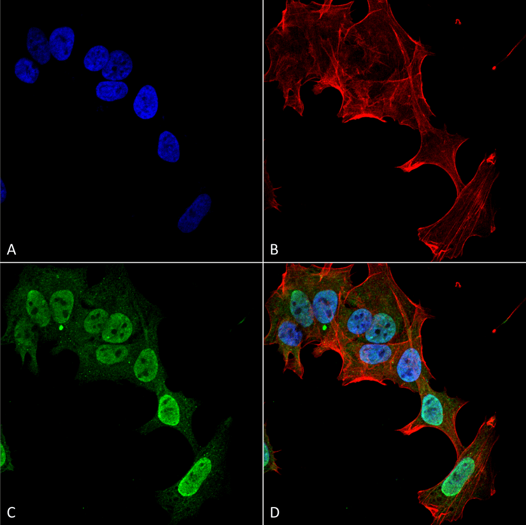  - mGluR1/5 Antibody ASM10241