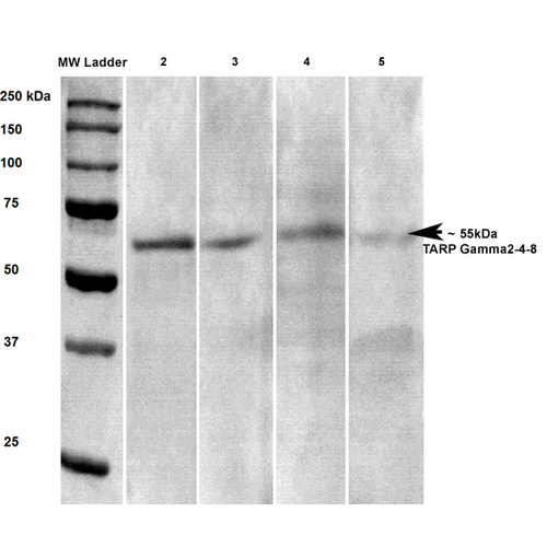 WB - TARP Gamma2/4/8 (Stargazin) Antibody ASM10256