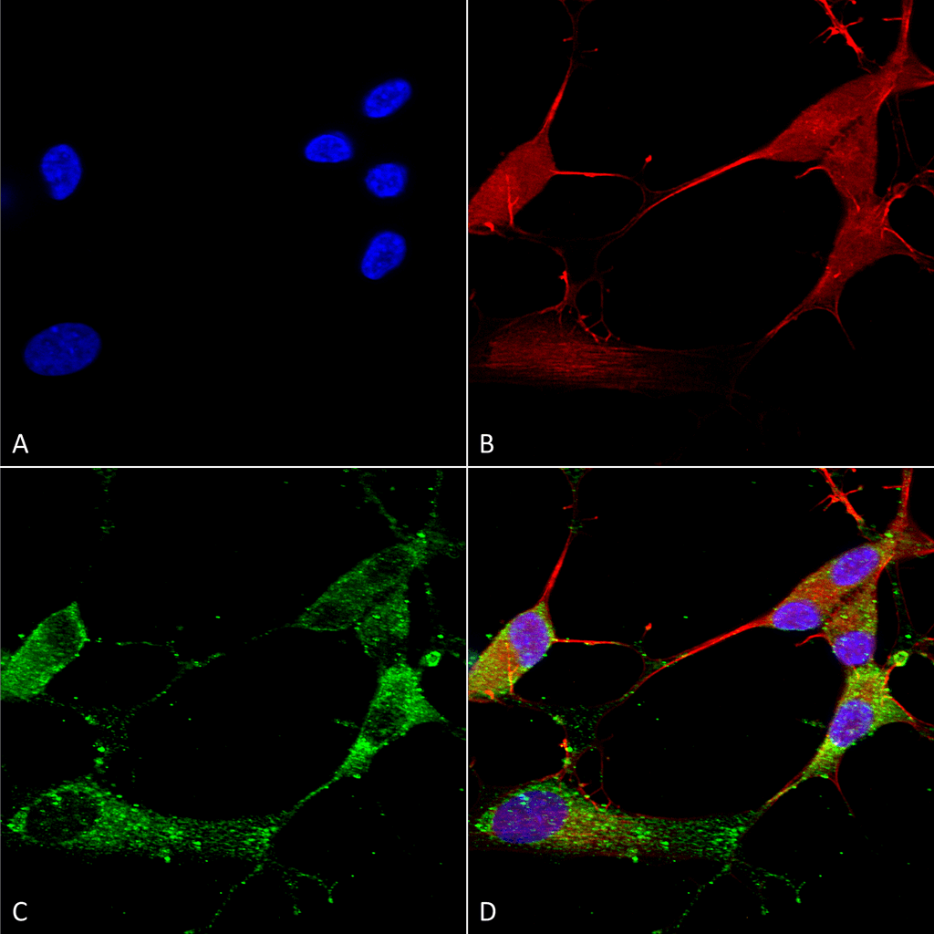  - TARP Gamma2/4/8 (Stargazin) Antibody ASM10256