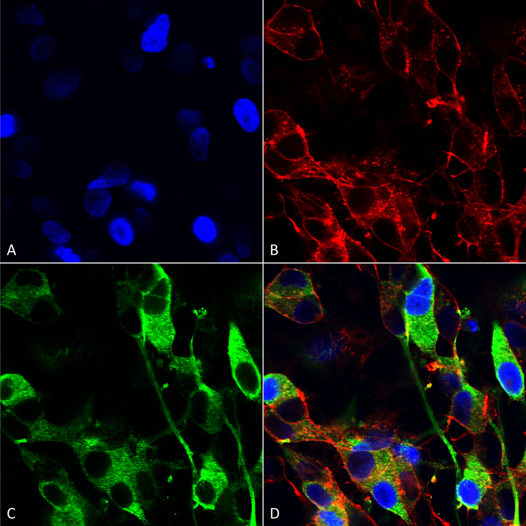  - Versican Antibody ASM10273